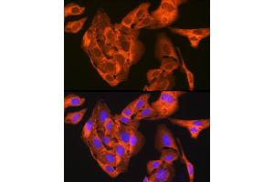 Immunofluorescence analysis of U-2 OS cells using JNK1/JNK3 Rabbit mAb (ABIN1678909, ABIN7101754, ABIN7101755 and ABIN7101756) at dilution of 1:100 (40x lens). (JNK 抗体)
