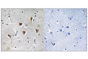 Immunohistochemistry (IHC) image for anti-Mitochondrial Transcription Termination Factor (MTERF) (Internal Region) antibody (ABIN1852304) (MTERF 抗体  (Internal Region))