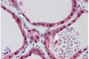 Human Thyroid: Formalin-Fixed, Paraffin-Embedded (FFPE) (PGK1 抗体  (AA 102-151))