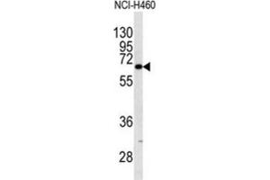 Western Blotting (WB) image for anti-Keratin 9 (KRT9) antibody (ABIN5023183) (KRT9 抗体)