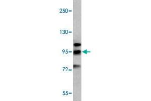 Western blot analysis of K-562 cell lysate (35 ug/lane) with GRM6 polyclonal antibody . (Metabotropic Glutamate Receptor 6 抗体  (C-Term))
