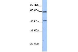 WB Suggested Anti-CCDC60 Antibody Titration: 0. (CCDC60 抗体  (C-Term))