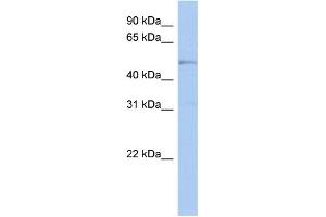 WB Suggested Anti-TBC1D10C Antibody Titration: 0. (Carabin 抗体  (N-Term))