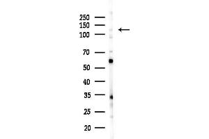 anti-Ubiquitin Specific Peptidase 43 (USP43) (N-Term) antibody