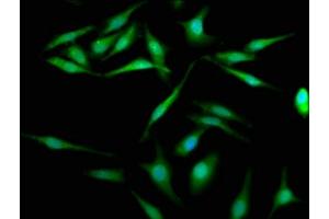 Immunofluorescence staining of Hela cells with ABIN7157656 at 1:200, counter-stained with DAPI. (KIFC1 抗体  (AA 337-498))