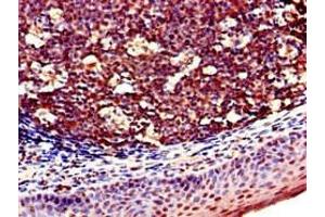 Immunohistochemistry (IHC) image for anti-Killer Cell Lectin-Like Receptor Subfamily D, Member 1 (KLRD1) (AA 42-168) antibody (ABIN7161085)