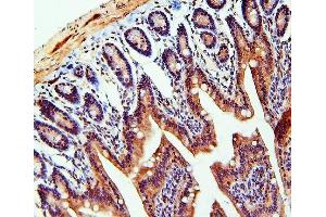 IHC analysis of TDRD3 using anti-TDRD3 antibody (ABIN6719636). (TDRD3 抗体)