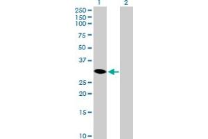 Western Blot analysis of HSD17B14 expression in transfected 293T cell line by HSD17B14 MaxPab polyclonal antibody. (HSD17B14 抗体  (AA 1-270))