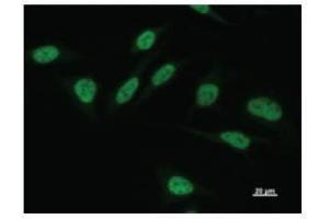 Immunostaining analysis in HeLa cells. (POU2F1 抗体)