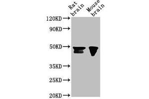 Western Blot Positive WB detected in: Rat brain tissue, Mouse brain tissue All lanes: NANOG antibody at 1:500 Secondary Goat polyclonal to Mouse IgG at 1/10000 dilution Predicted band size: 35, 33 kDa Observed band size: 46, 42 kDa (Nanog 抗体  (AA 1-305))