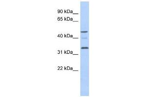 Cyclin Y-Like 1 antibody used at 1 ug/ml to detect target protein. (CCNYL1 抗体  (N-Term))