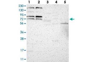 Western blot analysis of Lane 1: RT-4, Lane 2: U-251 MG, Lane 3: Human Plasma, Lane 4: Liver, Lane 5: Tonsil with ZNF90 polyclonal antibody . (ZNF90 抗体)