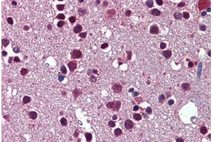 Human Brain, Cortex: Formalin-Fixed, Paraffin-Embedded (FFPE) (SRSF3 抗体  (AA 38-87))