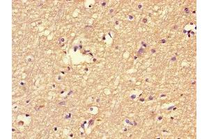 Immunohistochemistry of paraffin-embedded human brain tissue using ABIN7152464 at dilution of 1:100 (FBXL18 抗体  (AA 1-365))