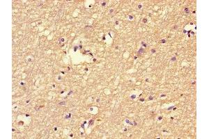 Immunohistochemistry of paraffin-embedded human brain tissue using ABIN7152464 at dilution of 1:100