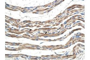 Pannexin 2 antibody was used for immunohistochemistry at a concentration of 4-8 ug/ml to stain Skeletal muscle cells (arrows) in Human Muscle. (Pannexin 2 抗体  (N-Term))