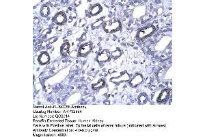 Human kidney (FOXP1 抗体  (N-Term))