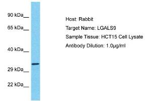 Host: Rabbit Target Name: LGALS9 Sample Tissue: Human HCT15 Whole Cell Antibody Dilution: 1ug/ml (Galectin 9 抗体  (Middle Region))