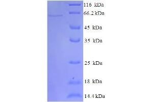 SDS-PAGE (SDS) image for Indoleamine 2,3-Dioxygenase 2 (IDO2) (AA 1-407), (full length) protein (His-SUMO Tag) (ABIN5709705)