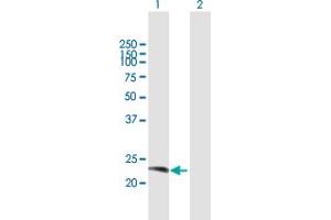 Western Blot analysis of RAB38 expression in transfected 293T cell line by RAB38 MaxPab polyclonal antibody. (RAB38 抗体  (AA 1-211))