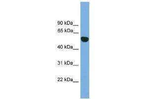 WB Suggested Anti-EPHX1 Antibody Titration: 0. (EPHX1 抗体  (N-Term))