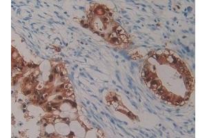 Immunohistochemistry (IHC) image for anti-S100 Calcium Binding Protein P (S100P) (AA 1-95) antibody (ABIN7434620)