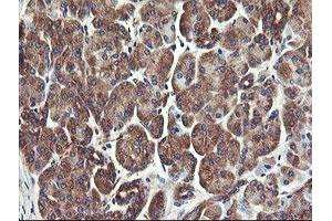 Image no. 18 for anti-Ubiquitin-Conjugating Enzyme E2, J1, U (UBE2J1) antibody (ABIN1501638)