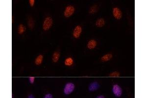 Immunofluorescence analysis of U-2OS cells using PCGF1 Polyclonal Antibody at dilution of 1:100. (PCGF1 抗体)