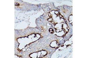 Immunohistochemistry (IHC) image for anti-Carcinoembryonic Antigen-Related Cell Adhesion Molecule 1 (CEACAM1) (AA 300-430) antibody (ABIN3015547)