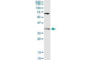 DKK1 monoclonal antibody (M06), clone 4C10. (DKK1 抗体  (AA 81-180))