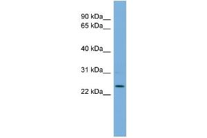 WB Suggested Anti-THAP6 Antibody Titration: 0. (THAP6 抗体  (Middle Region))
