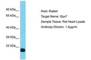 Image no. 1 for anti-Glutathione Peroxidase 7 (GPX7) (AA 105-154) antibody (ABIN6750347) (Glutathione Peroxidase 7 抗体  (AA 105-154))
