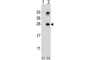 Western blot analysis of DHFR antibody and 293 cell lysate either nontransfected (Lane 1) or transiently transfected (2) with the DHFR gene. (Dihydrofolate Reductase 抗体  (AA 135-164))