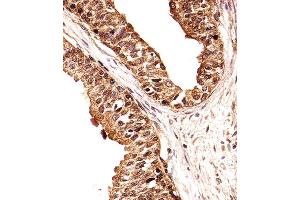 Immunohistochemical analysis of paraffin-embedded H. (ECE2 抗体  (AA 551-579))