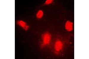 Immunofluorescent analysis of IPPK staining in NIH3T3 cells.