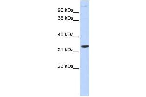 Western Blotting (WB) image for anti-Acidic (Leucine-Rich) Nuclear phosphoprotein 32 Family, Member B (ANP32B) antibody (ABIN2459518) (ANP32B 抗体)