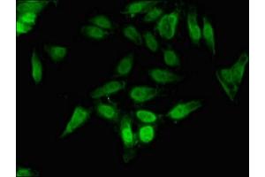 Immunofluorescent analysis of Hela cells using ABIN7148687 at dilution of 1:100 and Alexa Fluor 488-congugated AffiniPure Goat Anti-Rabbit IgG(H+L) (CrkL 抗体  (AA 98-303))