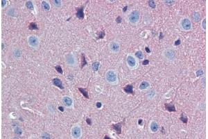 Immunohistochemistry (Paraffin-embedded Sections) (IHC (p)) image for anti-Guanine Nucleotide Binding Protein (G Protein), alpha Activating Activity Polypeptide O (GNAO1) (AA 345-354), (Subunit alpha) antibody (ABIN462341)
