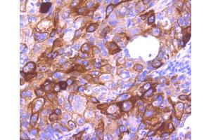 Immunohistochemistry (Paraffin-embedded Sections) (IHC (p)) image for anti-Keratin 16 (KRT16) antibody (ABIN5557440)