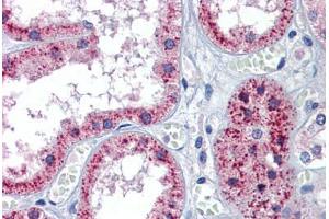 Human Kidney: Formalin-Fixed, Paraffin-Embedded (FFPE) (Patched 1 抗体  (AA 58-107))