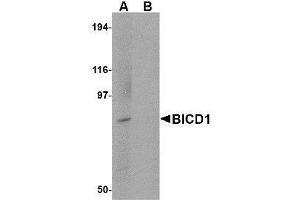 Western blot analysis of BICD1 in Daudi cell lysate with AP30144PU-N BICD1 antibody at 1 μg/ml in (A) the absence and (B) the presence of blocking peptide. (BICD1 抗体  (C-Term))