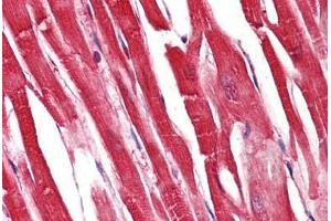 Anti-S100A1 / S100 antibody IHC staining of human heart.