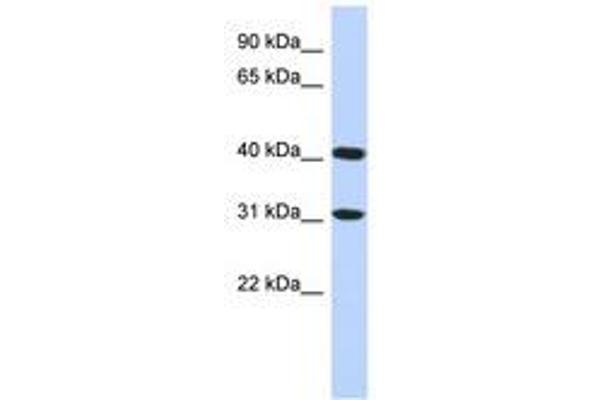FAM46D 抗体  (C-Term)