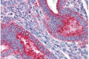 Human Uterus: Formalin-Fixed, Paraffin-Embedded (FFPE) (MVP 抗体  (AA 1-894))