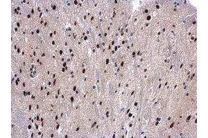 Immunohistochemistry (IHC) image for anti-DEAD (Asp-Glu-Ala-Asp) Box Polypeptide 39B (DDX39B) antibody (ABIN2855057)