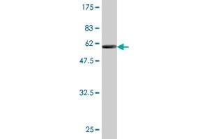 Western Blot detection against Immunogen (58. (Ketohexokinase 抗体  (AA 1-298))