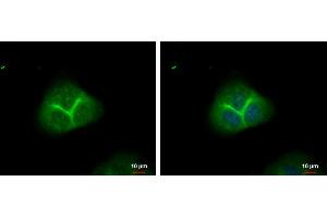 ICC/IF Image alpha Adducin antibody detects alpha Adducin protein at membrane by immunofluorescent analysis.