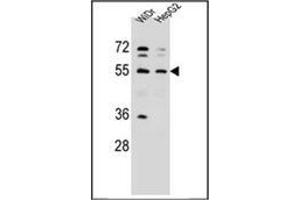 Western Blotting (WB) image for anti-Asparaginyl-tRNA Synthetase (NARS) (AA 31-60), (N-Term) antibody (ABIN953606)