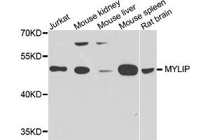 Western blot analysis of extract of various cells, using IDOL antibody. (MYLIP 抗体)