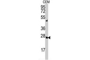 Western blot analysis of AK2 polyclonal antibody  in CEM cell lysate (35 ug/lane). (Adenylate Kinase 2 抗体  (N-Term))